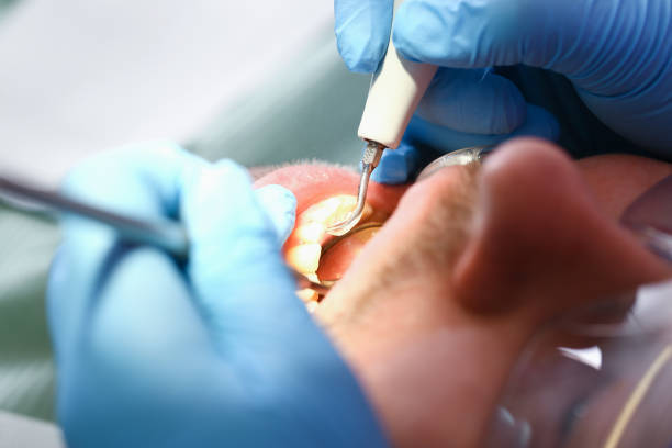 Best Emergency Dentist for Lost Fillings or Crowns in Lone Oak, TN