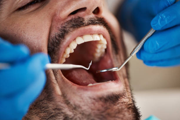 Best Emergency Dental Services for Seniors in Lone Oak, TN